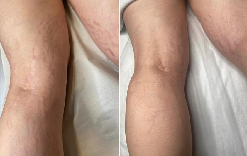 Recupera la confianza en tu piel.